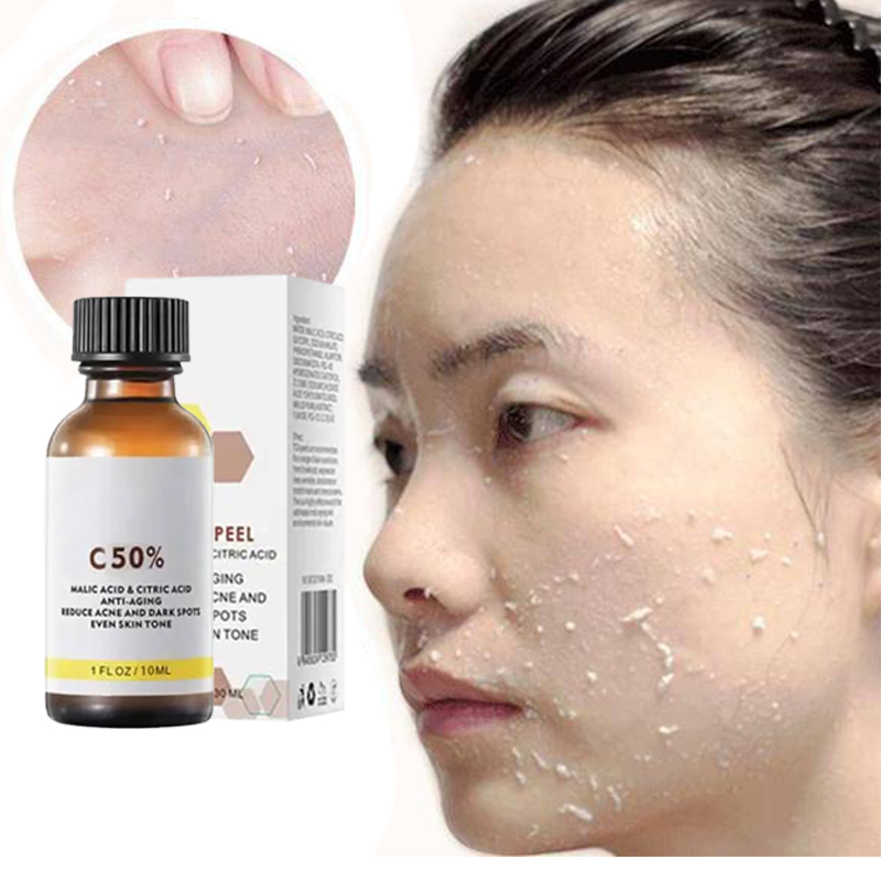Azelaic Acid Serum - Huile exfoliante 3-en-1 pour les taches