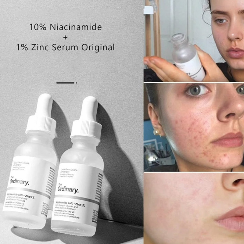 Sérum The Ordinary Niacinamide - Skincare La Roche Posay avis et prix