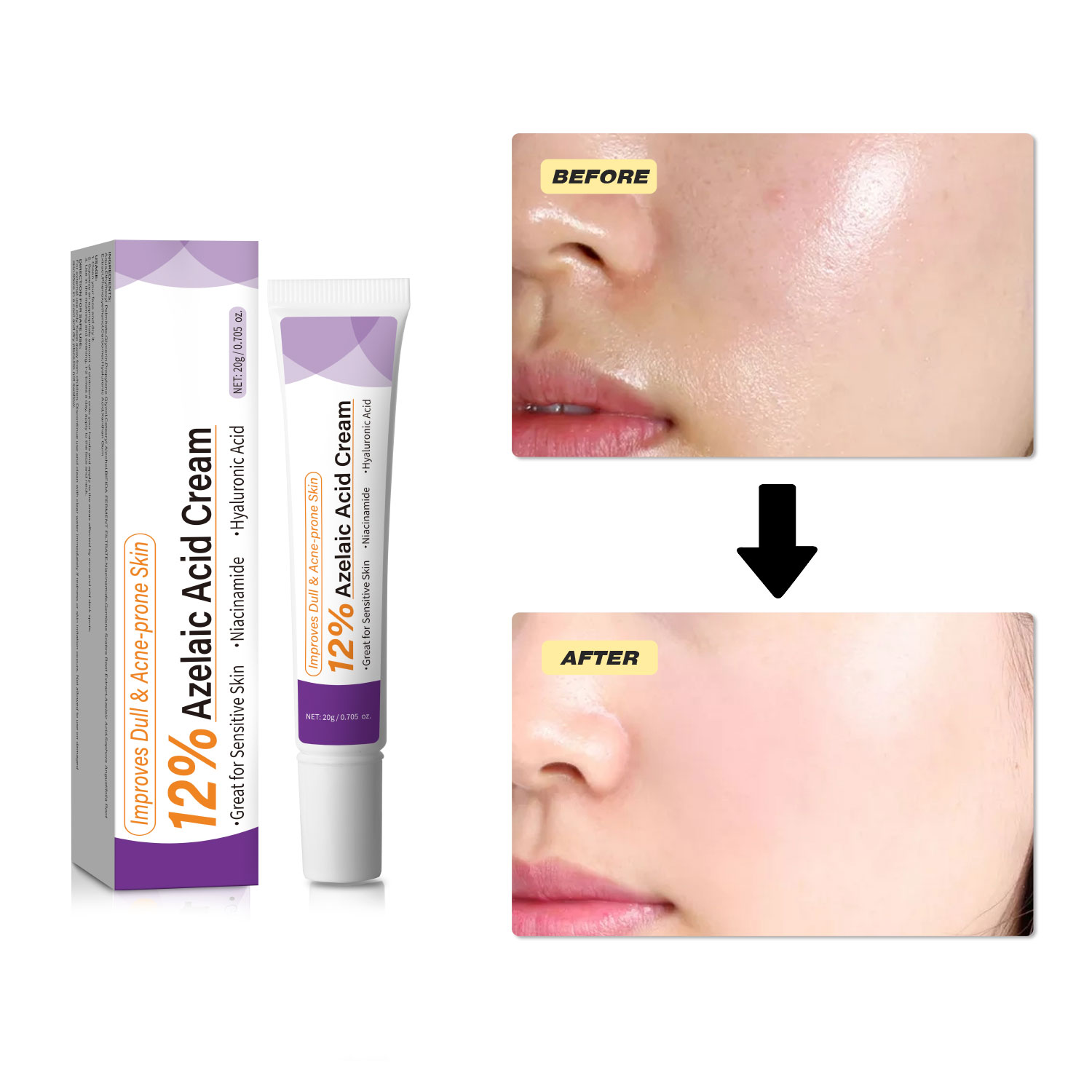 Crème à l'acide azélaïque douc - Azelaic Acid Serum avis et prix