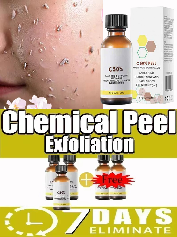 Huile exfoliante 3-en-1 pour l - Azelaic Acid Serum avis et prix