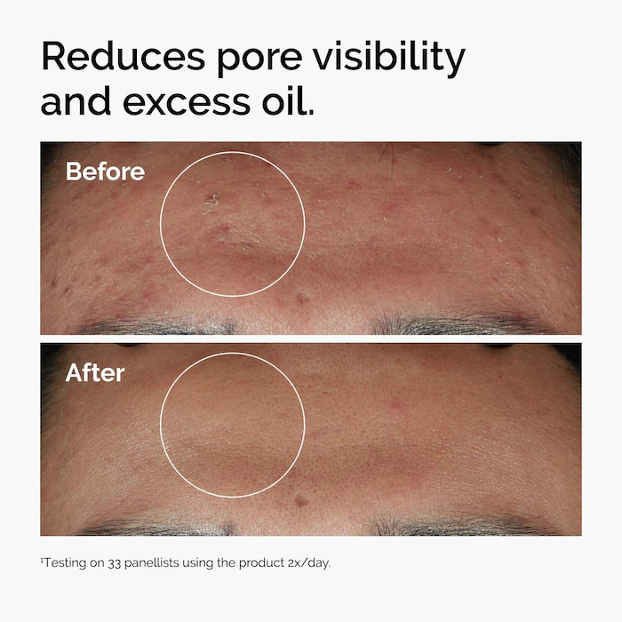 Niacinamide 10% + Zinc 1% séru - Skincare La Roche Posay avis et prix